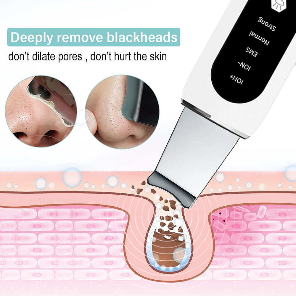 Ultrasonic Skin Scrubber Facial Peeling Machine Black Dots Acne Pore Deep Cleaning Ultrasonic Face Scrubber Blackhead Remover
