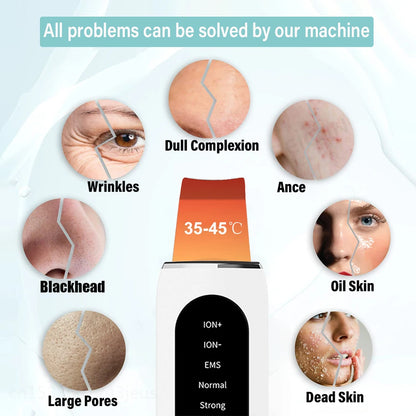 Ultrasonic Skin Scrubber Facial Peeling Machine Black Dots Acne Pore Deep Cleaning Ultrasonic Face Scrubber Blackhead Remover