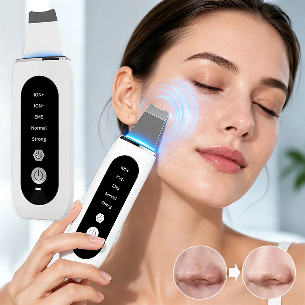 Ultrasonic Skin Scrubber Facial Peeling Machine Black Dots Acne Pore Deep Cleaning Ultrasonic Face Scrubber Blackhead Remover